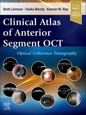 Coperta cărții "Clinical Atlas of Anterior Segment OCT: Optical Coherence Tomography" de Brett Levinson, Fasika Woreta, Kamran M. Riaz
