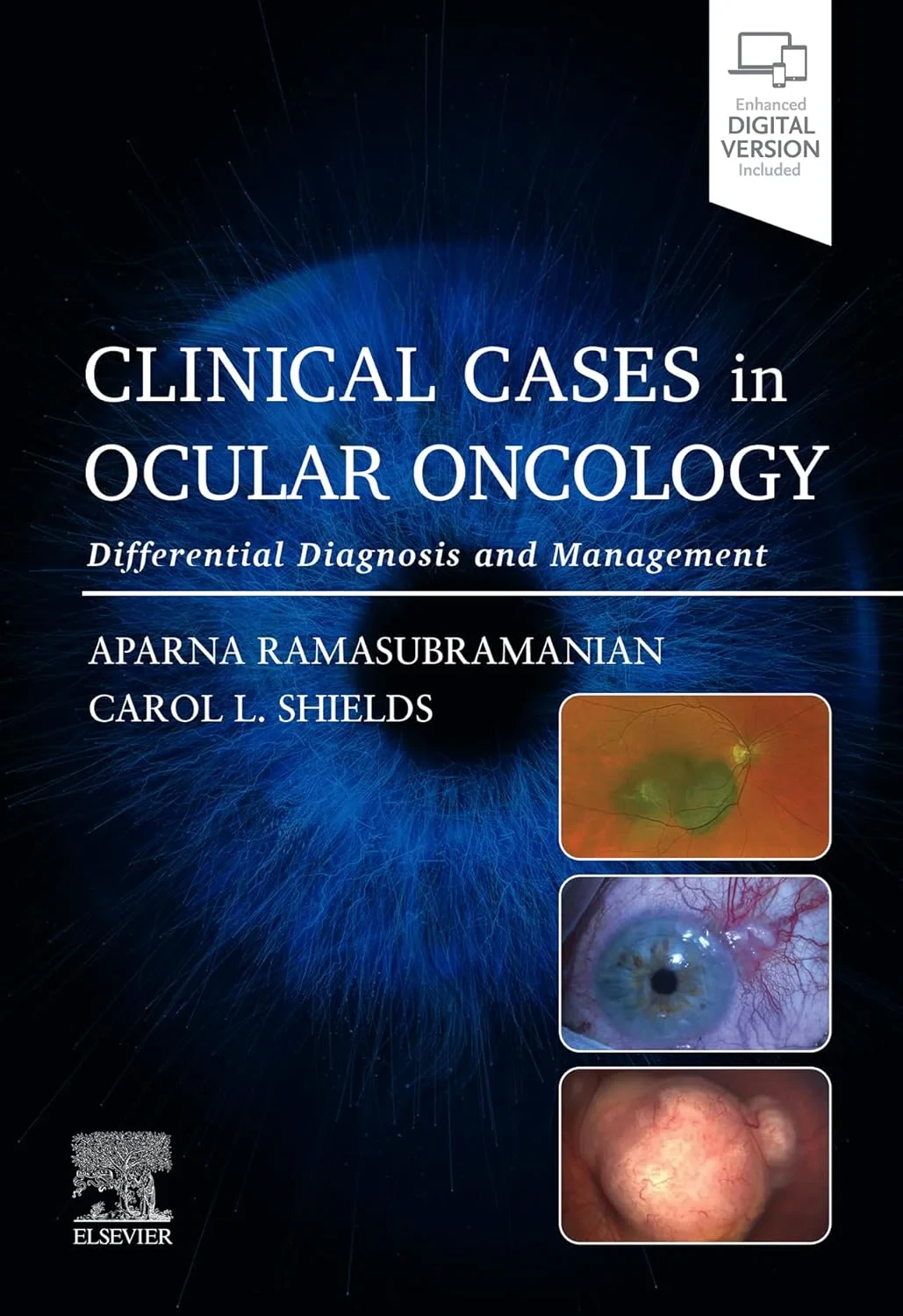 Coperta cărții "Clinical Cases in Ocular Oncology: Differential Diagnosis and Management" de Aparna Ramasubramanian, Carol L. Shields