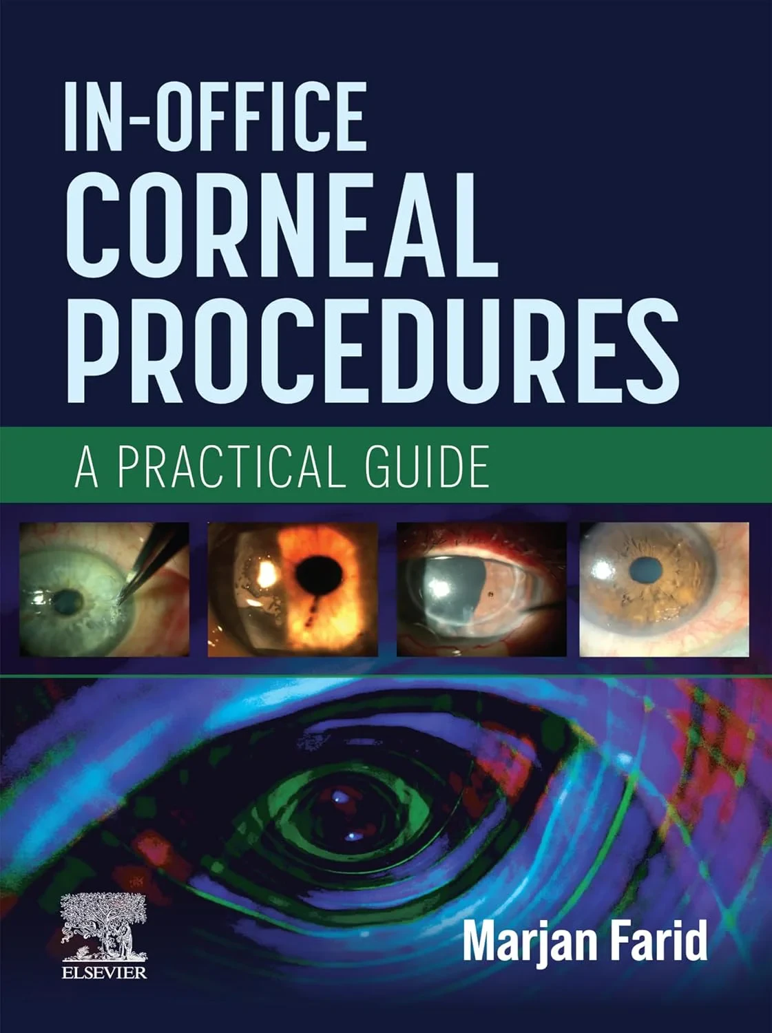 Coperta cărții "In-Office Corneal Procedures, 1st Edition" de Marjan Farid