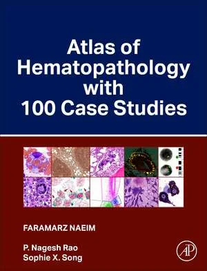 Coperta cărții "Atlas of Hematopathology with 100 Case Studies" de Faramarz Naeim, P. Nagesh Rao, Sophie X. Song