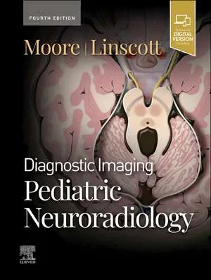 Coperta cărții "Diagnostic Imaging: Pediatric Neuroradiology,Fourth Edition" de Kevin R. Moore, Luke L. Linscott