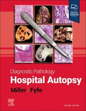 Coperta cărții "Diagnostic Pathology: Hospital Autopsy" de Dylan V. Miller, Billie S. Fyfe