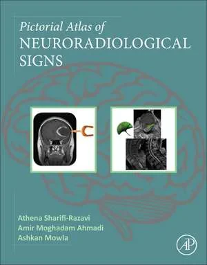 Coperta cărții "Pictorial Atlas of Neuroradiological Signs" de Athena Sharifi-Razavi, Amir Moghadam Ahmadi, Ashkan Mowla