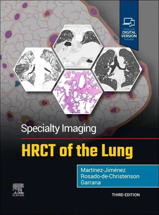Coperta cărții "Specialty Imaging: HRCT of the Lung" de autor necunoscut