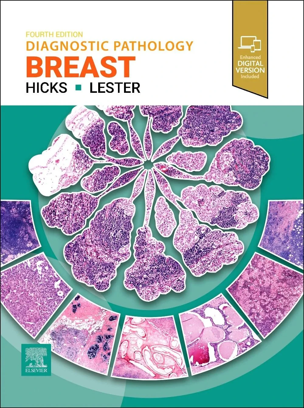 Coperta cărții "Diagnostic Pathology: Breast" de Susan C. Lester, David G. Hicks