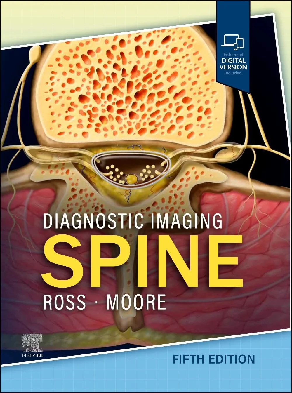 Coperta cărții "Diagnostic Imaging: Spine 5th Edition" de Kevin R. Moore, Jeffrey S. Ross