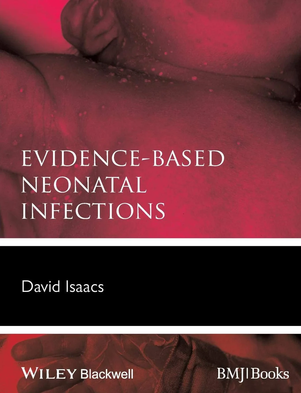 Coperta cărții "Evidence-Based Neonatal Infections " de David Isaacs