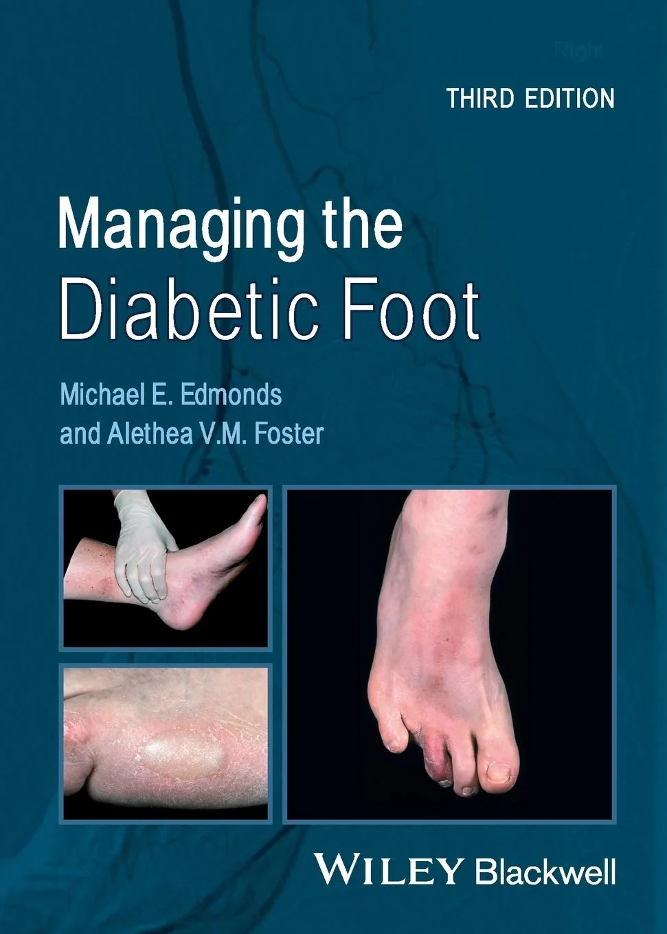 Coperta cărții "Managing the Diabetic Foot" de Michael E. Edmonds, Alethea V. M. Foster