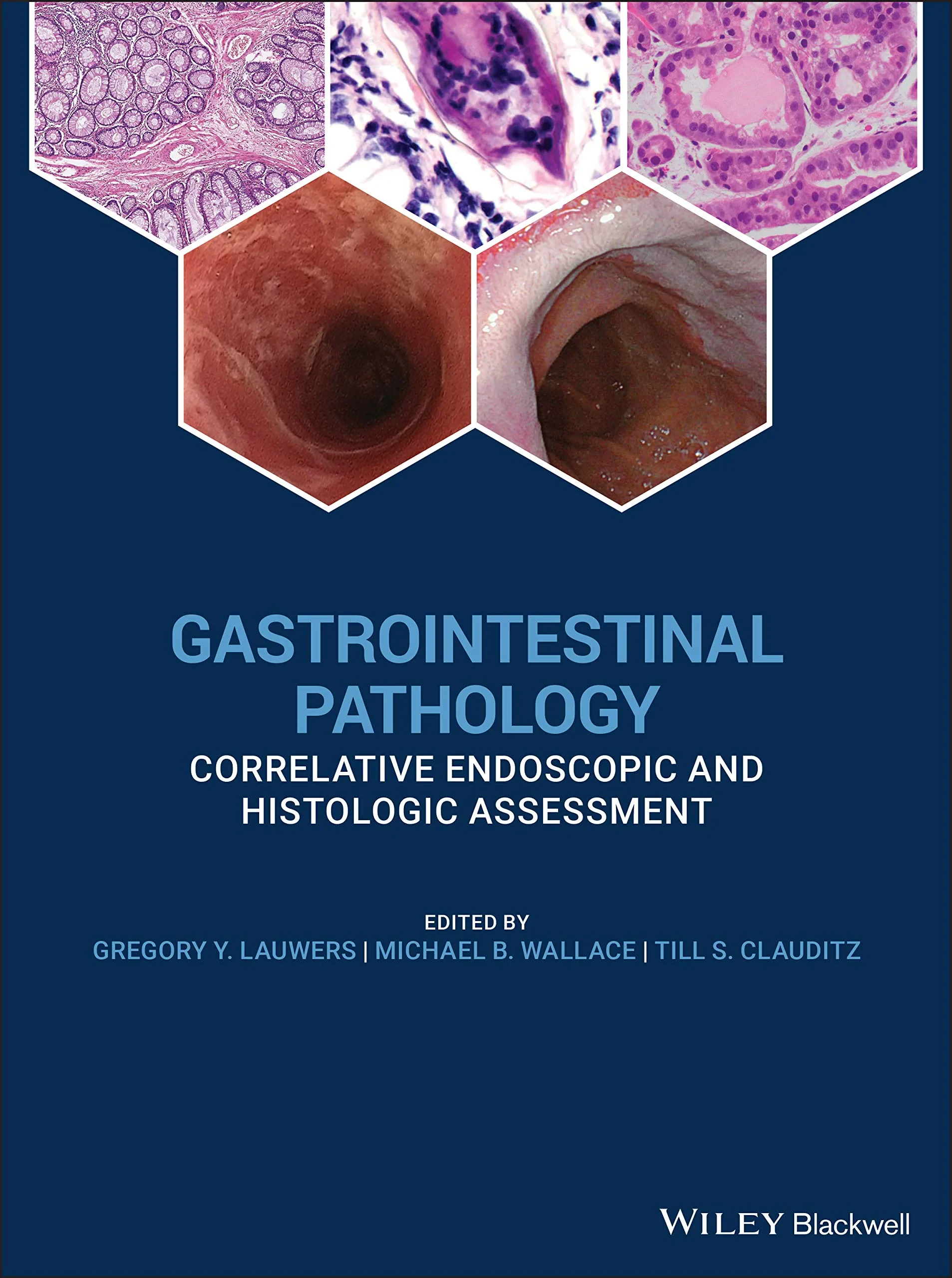 Coperta cărții "Gastrointestinal Pathology: Correlative Endoscopic and Histologic Assessment " de Michael B. Wallace, Gregory Y. Lauwers, Till S. Clauditz
