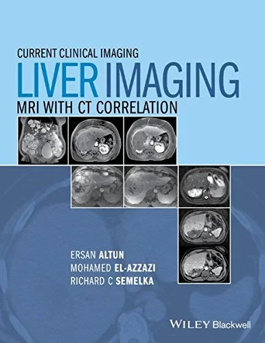 Coperta cărții "Liver Imaging: MRI with CT Correlation (Current Clinical Imaging)" de Ersan Altun, Mohamed El-Azzazi, Richard C. Semelka