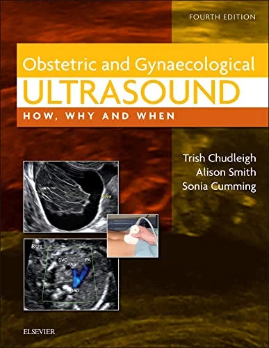 Coperta cărții "Obstetric &amp; Gynaecological Ultrasound: How, Why and When, 4e" de Trish Chudleigh, Alison Smith, Sonia Cumming