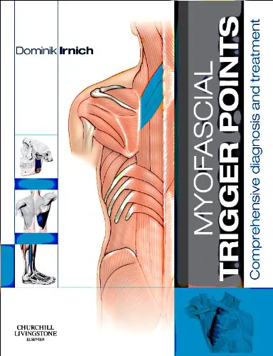 Coperta cărții "Myofascial Trigger Points: Comprehensive diagnosis and treatment, 1e" de Dominik Irnich