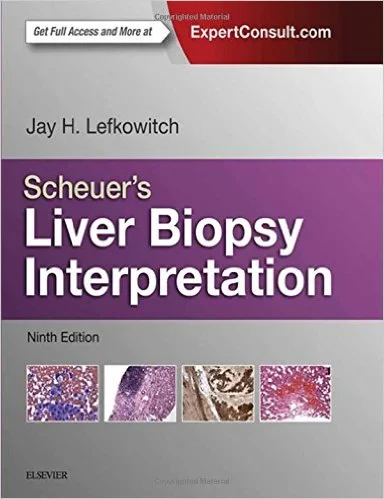 Coperta cărții "Scheuer’s Liver Biopsy Interpretation, 9e" de Jay H. Lefkowitch