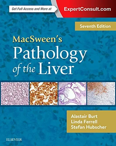 Coperta cărții "MacSween’s Pathology of the Liver, 7th Edition" de Alastair D. Burt, Linda D. Ferrell, Stefan G Hubscher