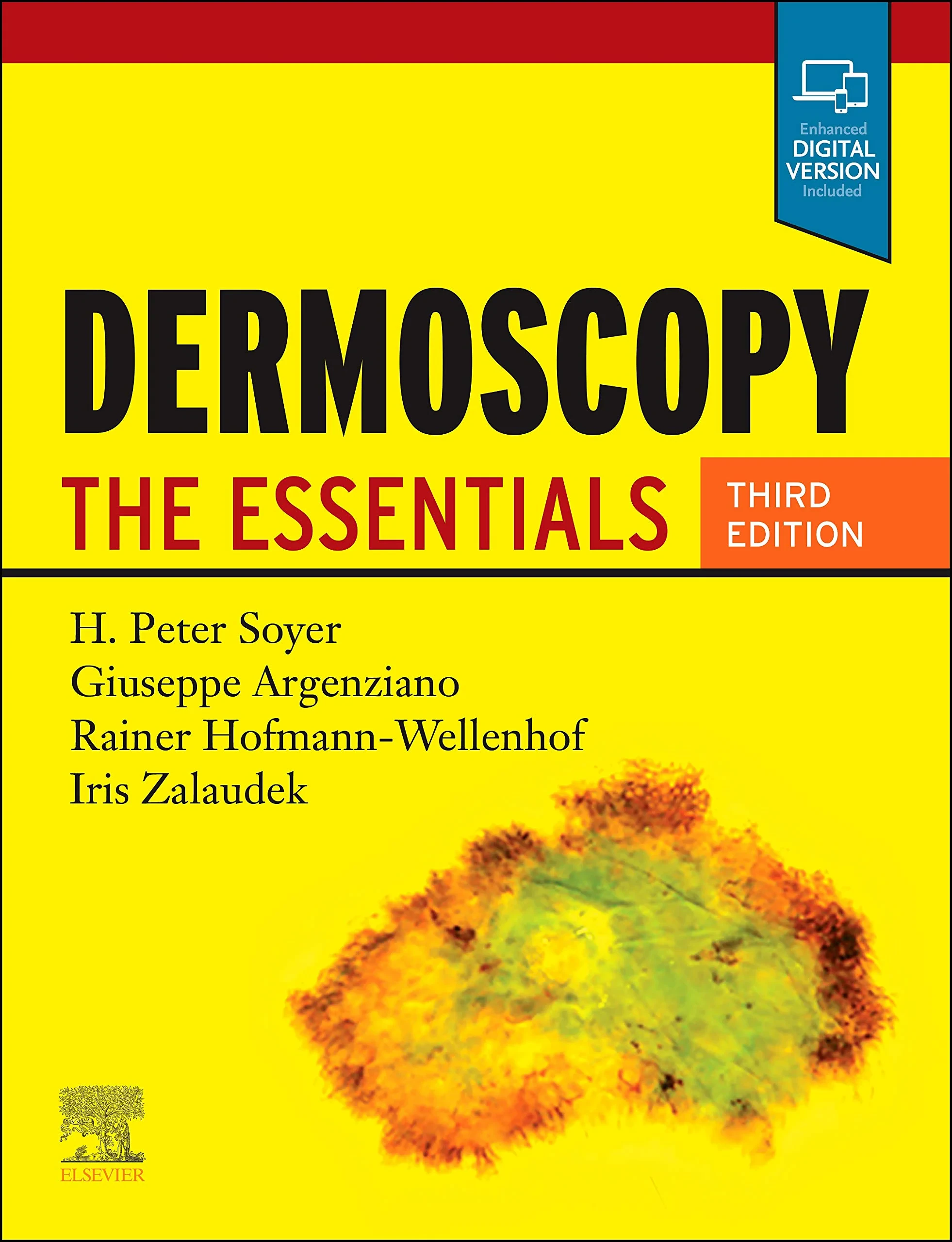 Coperta cărții "Dermoscopy: The Essentials" de H. Peter Soyer MD FACD (Author), Giuseppe Argenziano MD (Author), Rainer Hofmann-Wellenhof MD (Author), Iris Zalaudek MD