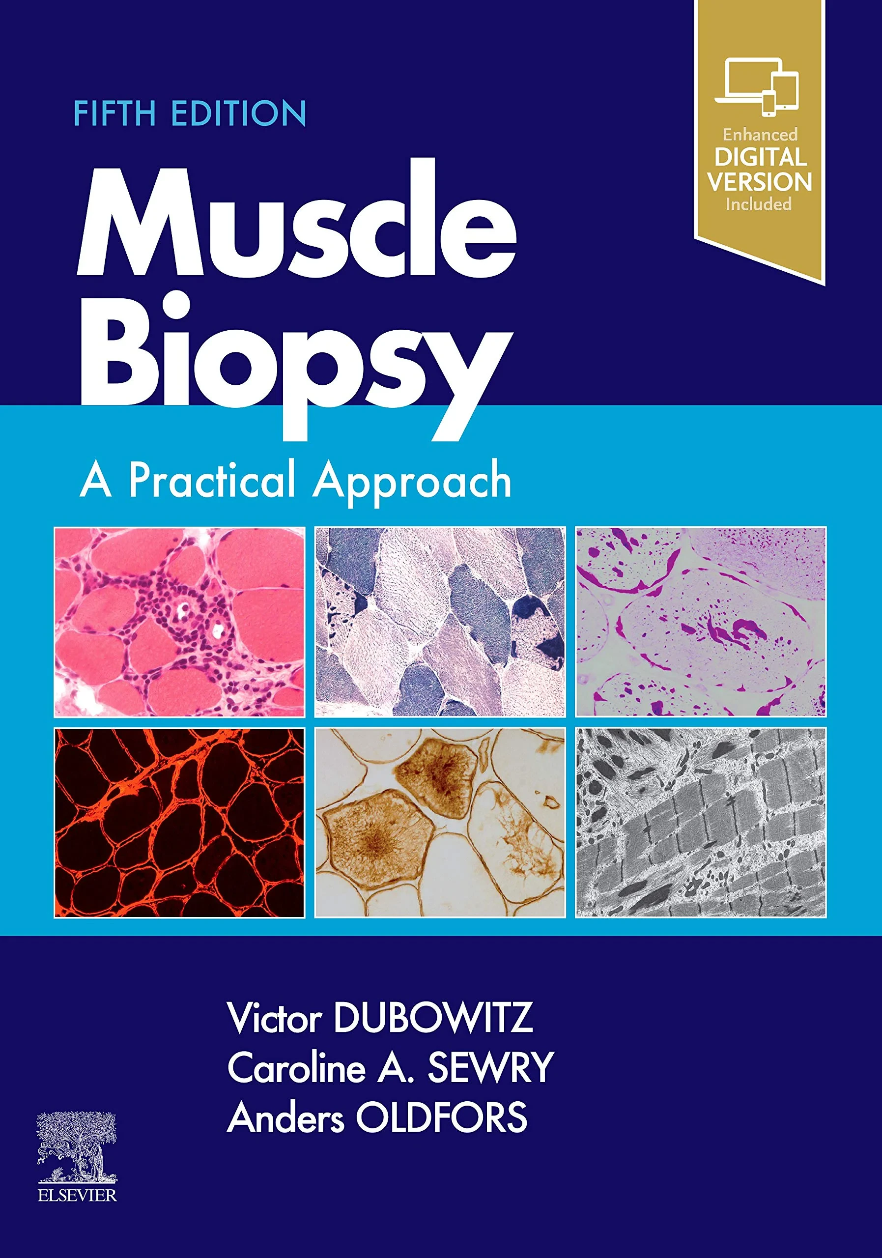 Coperta cărții "Muscle Biopsy: A Practical Approach" de Victor Dubowitz MD PhD FRCP FRCPCH, Caroline A. Sewry BSc PhD FRCPath