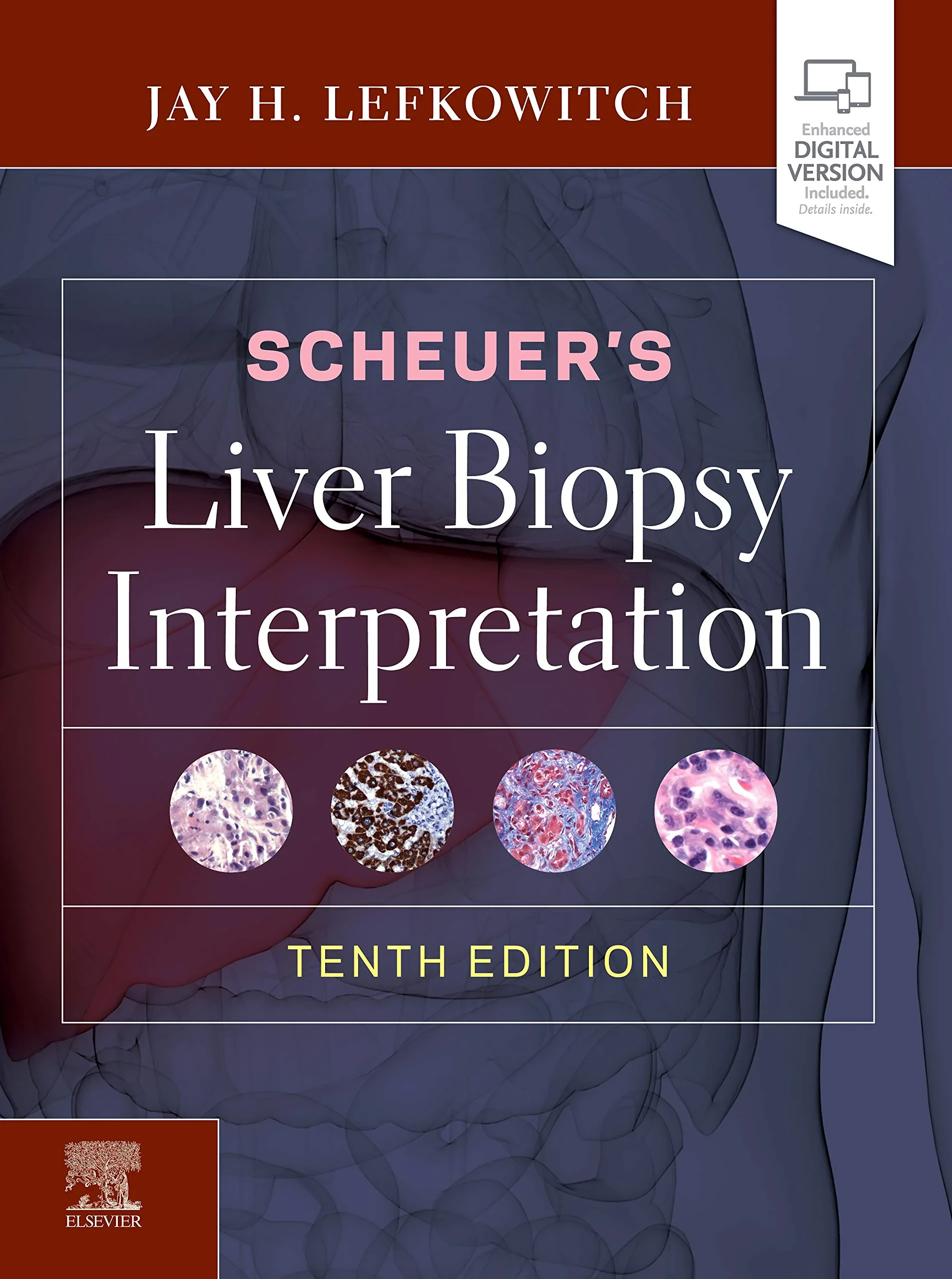 Coperta cărții "Scheuer’s Liver Biopsy Interpretation" de Jay H. Lefkowitch MD