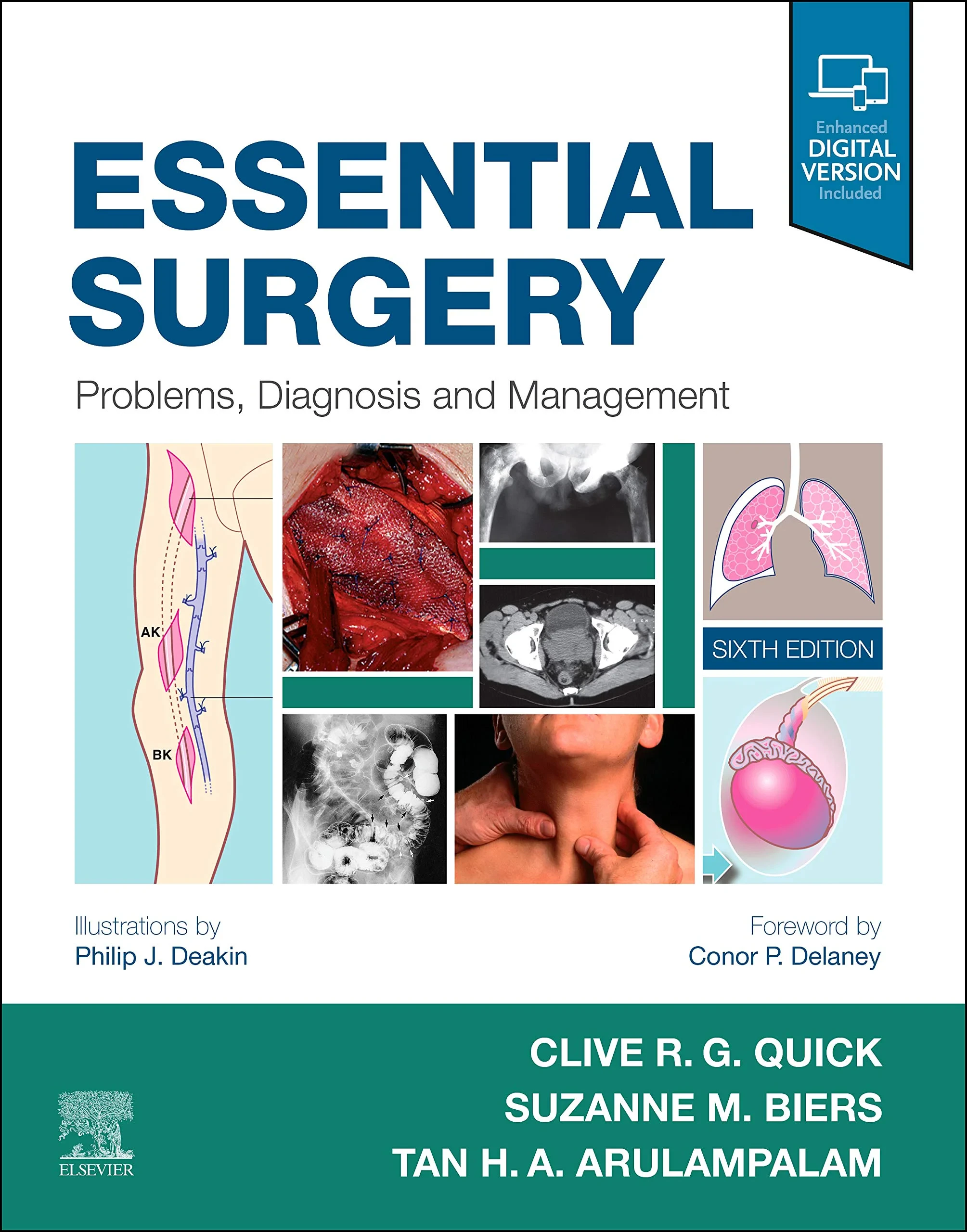 Coperta cărții "Essential Surgery: Problems, Diagnosis and Management" de Clive R. G. Quick MB BS, FDS FRCS, MS(London) MA(Cambridge)