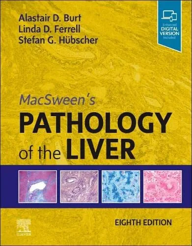 Coperta cărții "MacSween’s Pathology of the Liver " de Burt, Ferrell &amp; Hübscher