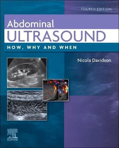 Coperta cărții "Abdominal Ultrasound: How, Why and When" de Nicola Davidson