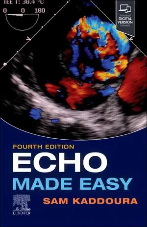 Coperta cărții "Echo Made Easy" de Sam Kaddoura