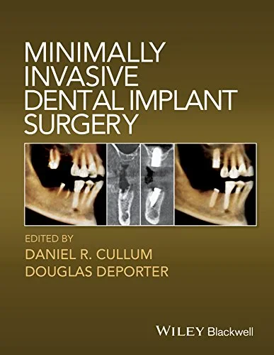 Coperta cărții "Minimally Invasive Dental Implant Surgery" de Douglas Deporter, Daniel R. Cullum