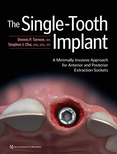 The Single-Tooth Implant: A Minimally Invasive App...