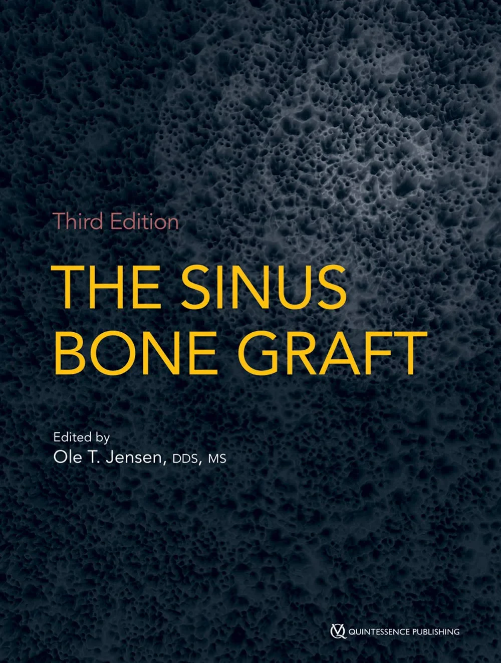 Coperta cărții "The Sinus Bone Graft" de Jensen, Ole T