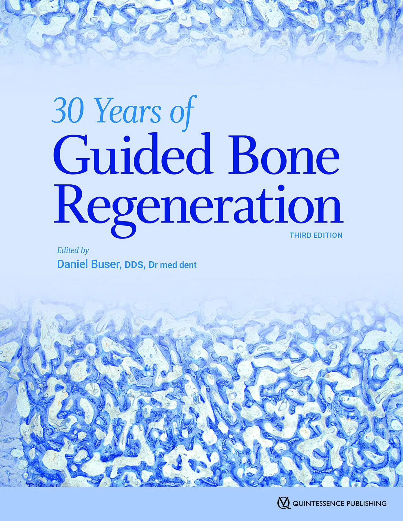 Coperta cărții "30 Years of Guided Bone Regeneration" de Daniel, Buser