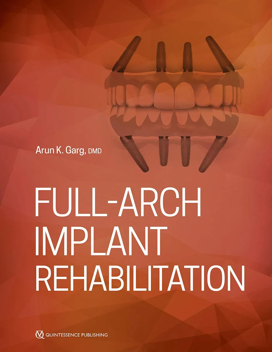 Coperta cărții "Full-Arch Implant Rehabilitation" de Garg, Arun K