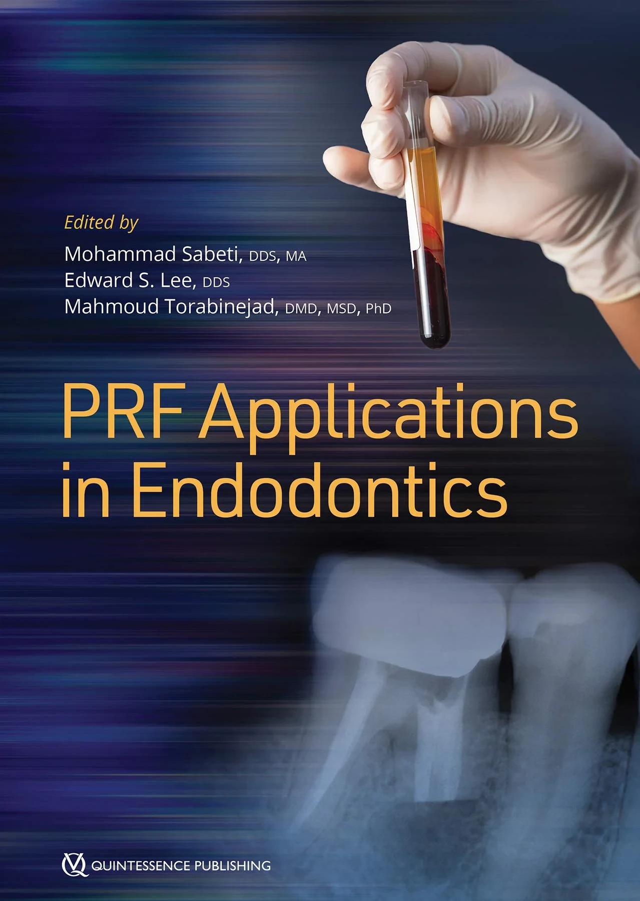 Coperta cărții "PRF Applications in Endodontics" de Sabeti, Mohammad / Lee, Edward S / Torabinejad, Mahmoud