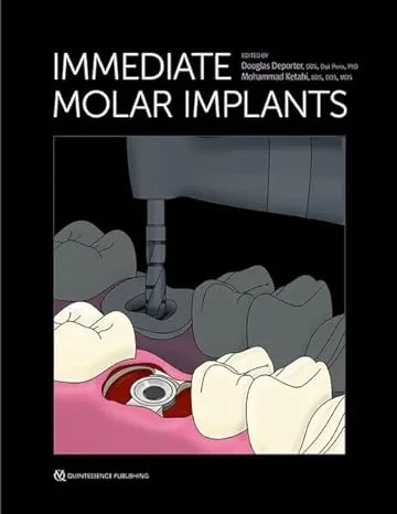 Coperta cărții "Immediate Molar Implants" de Douglas Deporter / Mohammad Ketabi