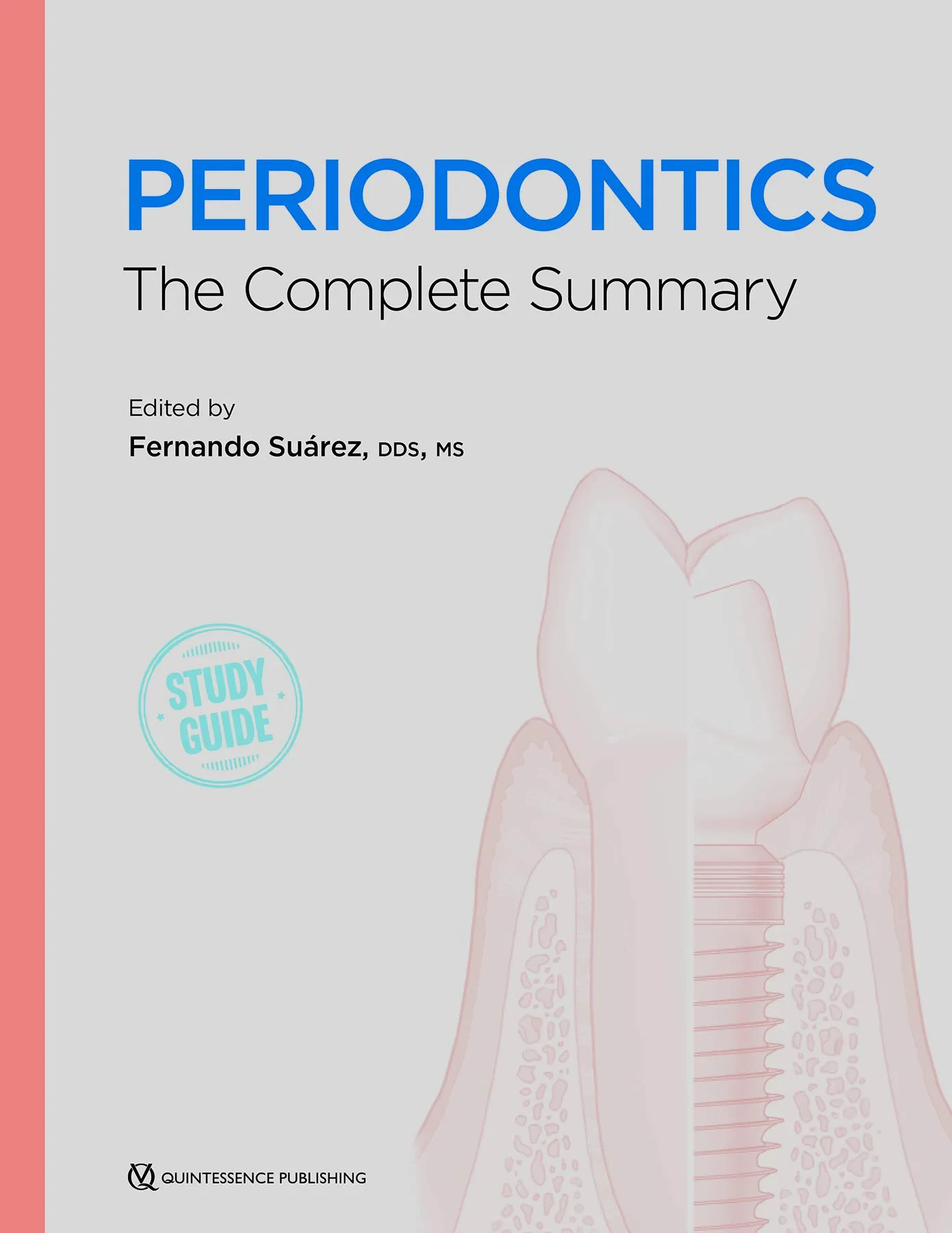 Coperta cărții "Periodontics: The Complete Summary" de Fernando, Su�rez