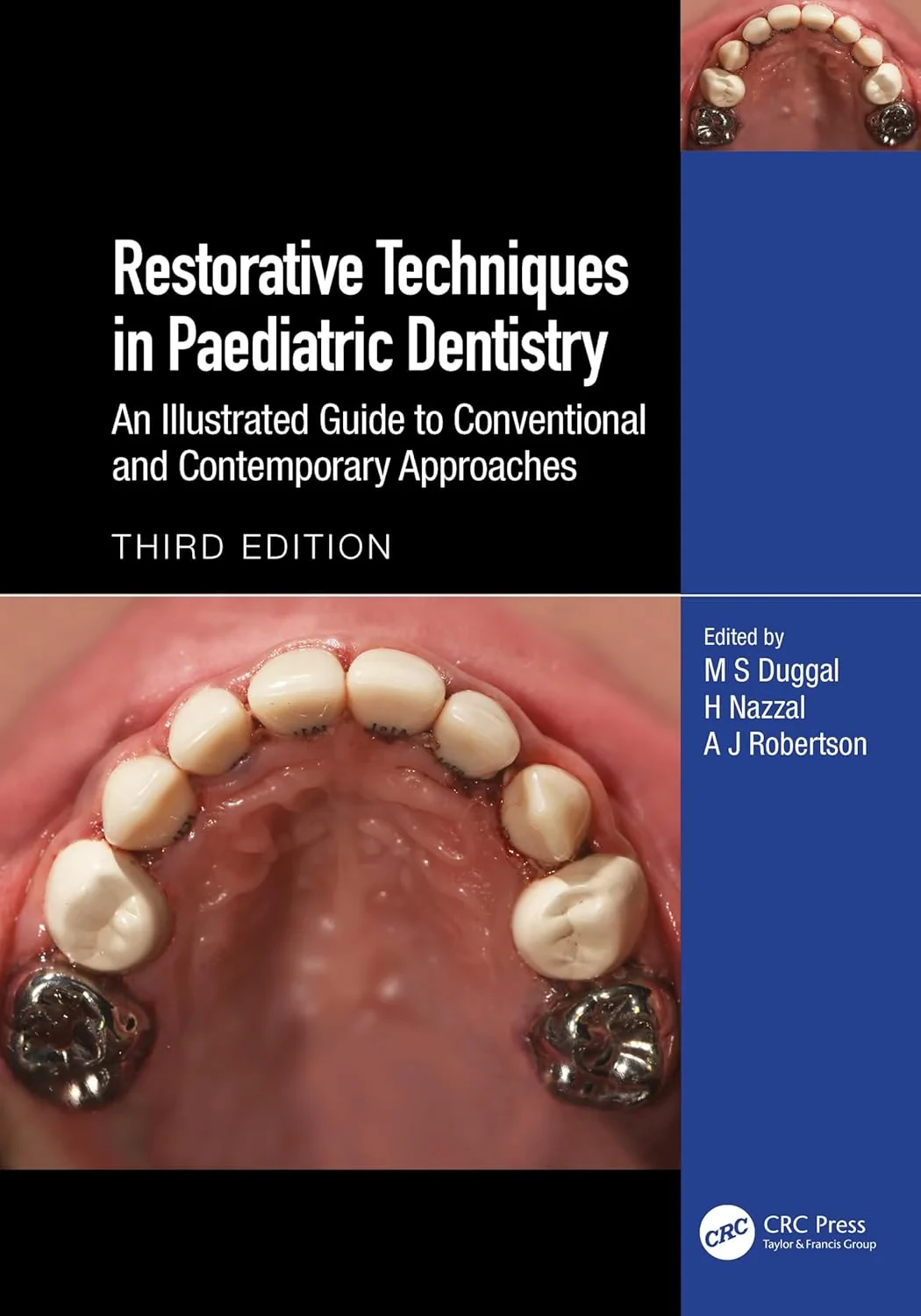 Coperta cărții "Restorative Techniques in Paediatric Dentistry: An Illustrated Guide to Conventional and Contemporary Approaches" de M S Duggal, H Nazzal, A J Robertson