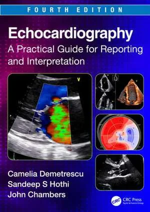 Coperta cărții "Echocardiography: A Practical Guide for Reporting and Interpretation, 4th Edition" de Camelia Demetrescu, Sandeep S. Hothi, John Chambers
