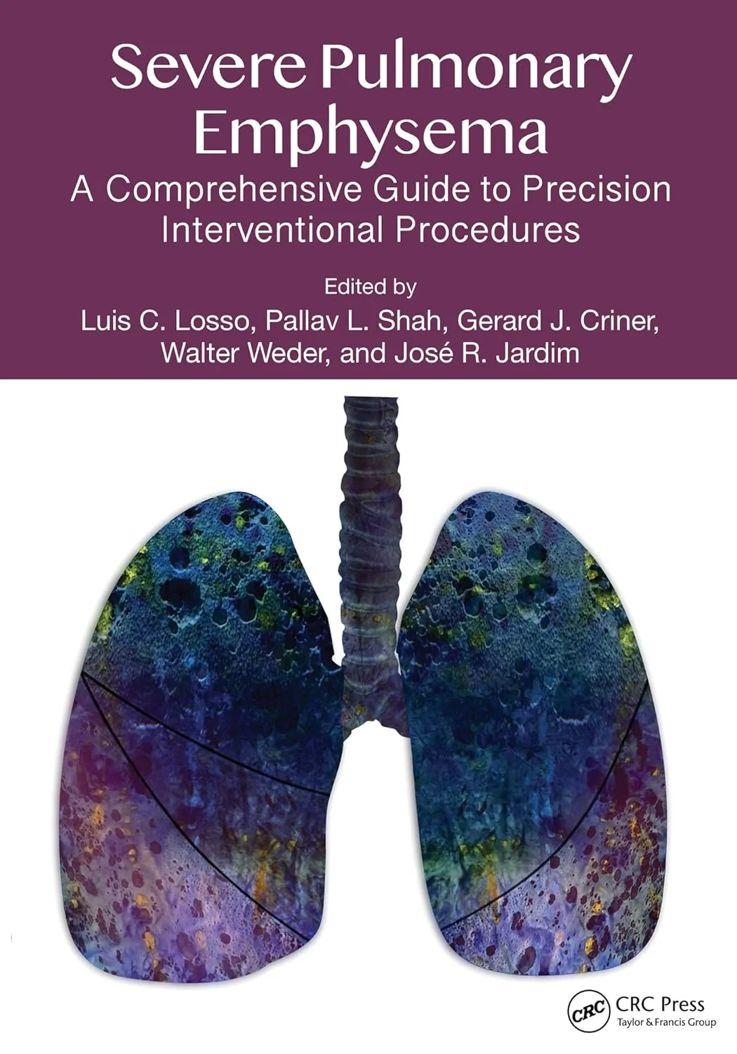 Coperta cărții "Severe Pulmonary Emphysema:: A Comprehensive Guide to Precision Interventional Procedures " de Luis C. Losso, Pallav L. Shah, Gerald J. Criner, Walter Weder, José R Jardim