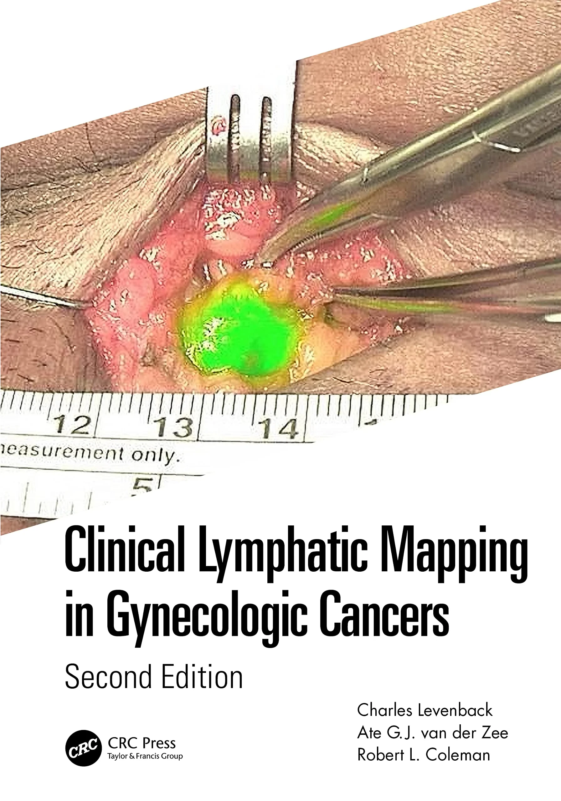 Coperta cărții "Clinical Lymphatic Mapping in Gynecologic Cancers " de Levenback, Charles, van der Zee, Ate GJ, Coleman, Robert L.