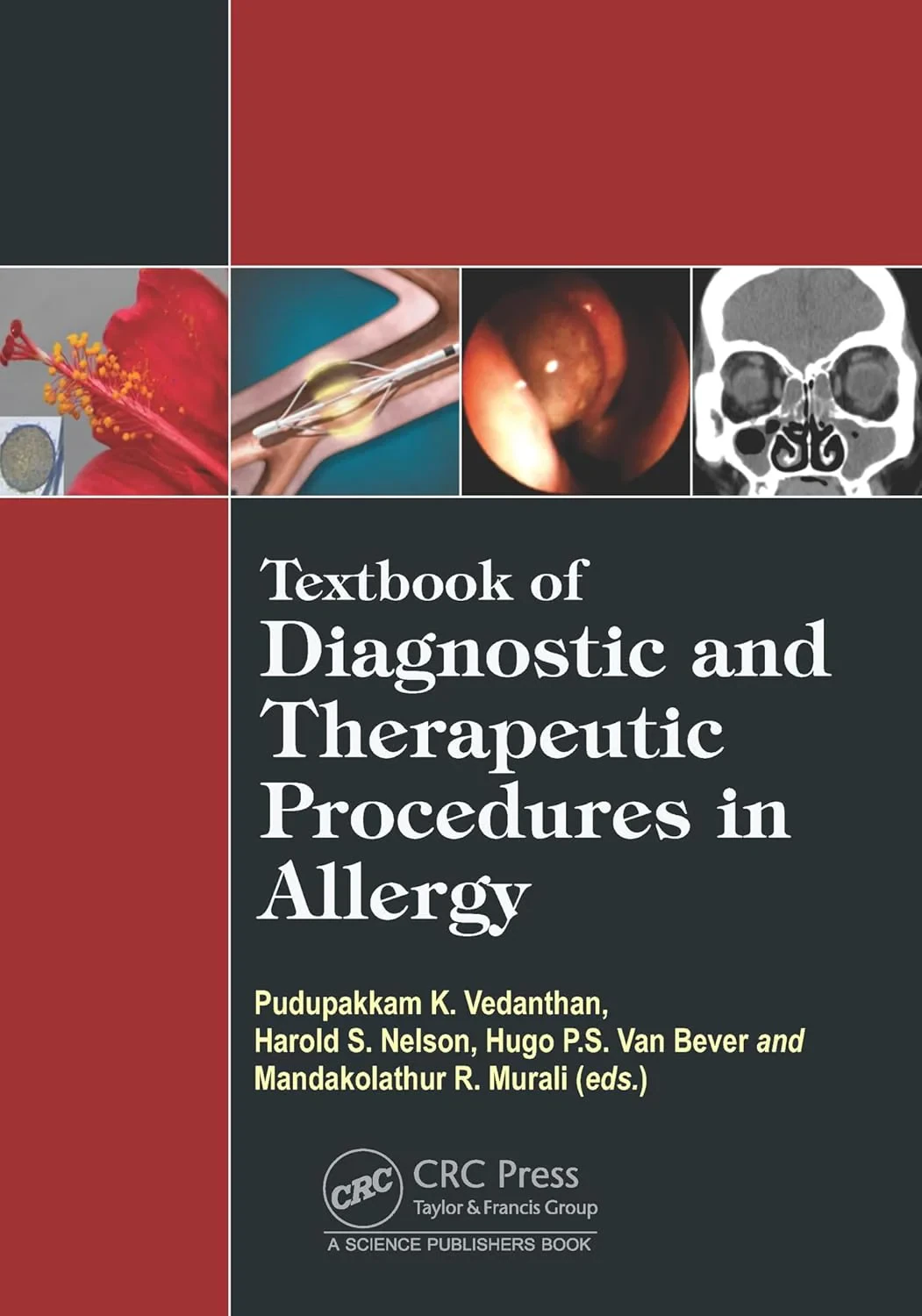Coperta cărții "Textbook of Diagnostic and Therapeutic Procedures in Allergy " de Pudupakkam K. Vedanthan, Harold S. Nelson, Hugo Van Bever, Mandakolathur R Murali