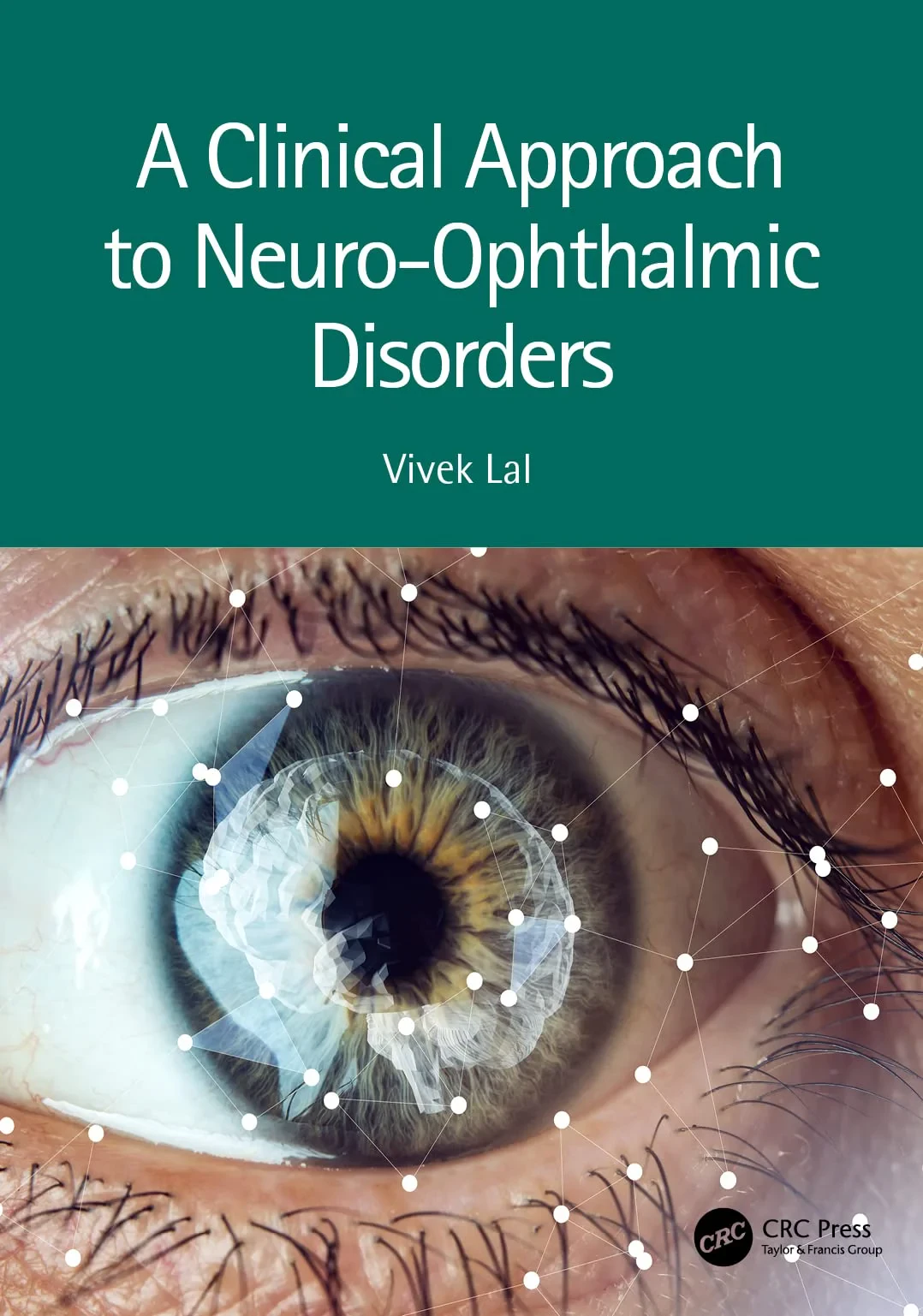 Coperta cărții "A Clinical Approach to Neuro-Ophthalmic Disorders" de Vivek Lal