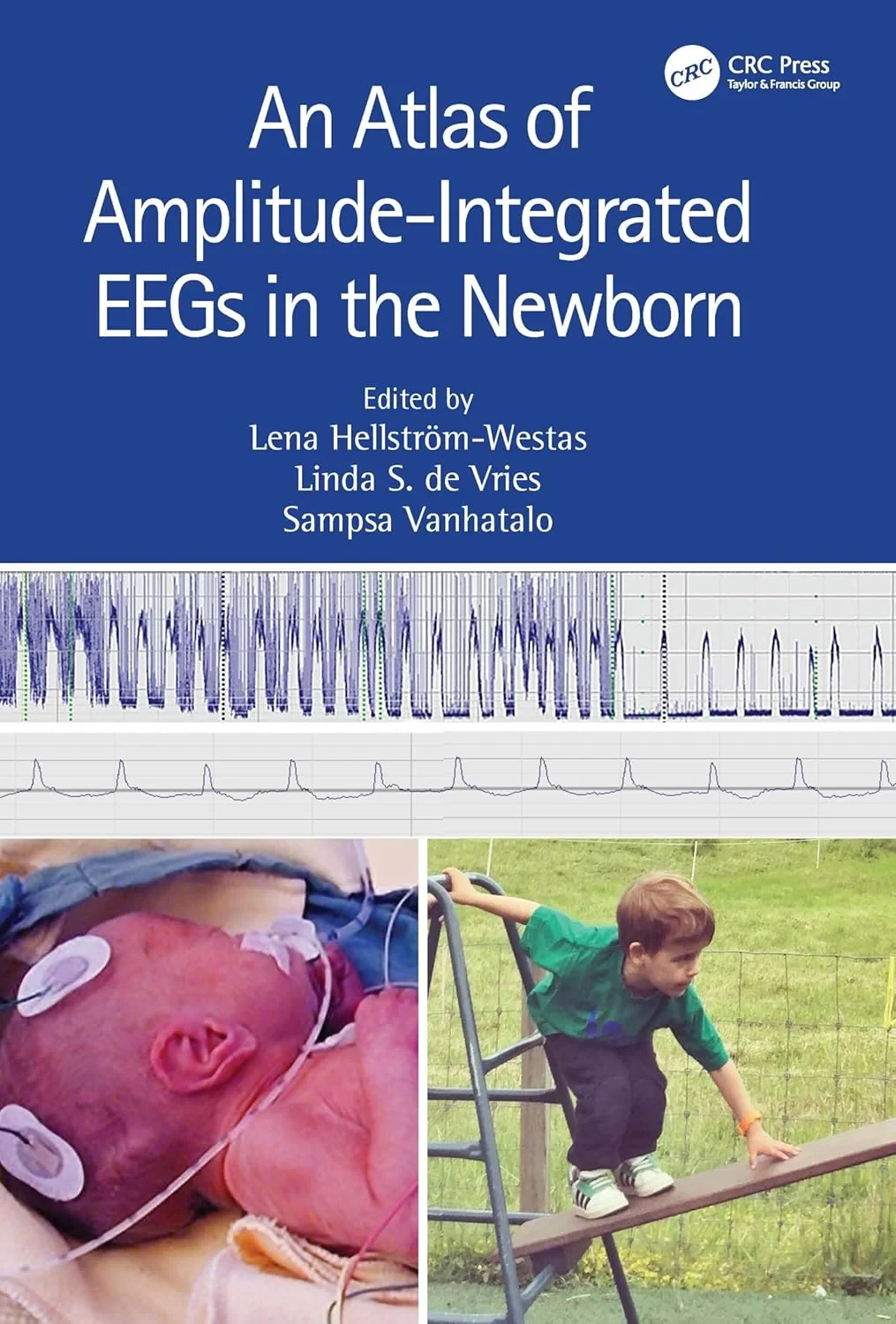 An Atlas of Amplitude-Integrated EEGs in the Newbo...