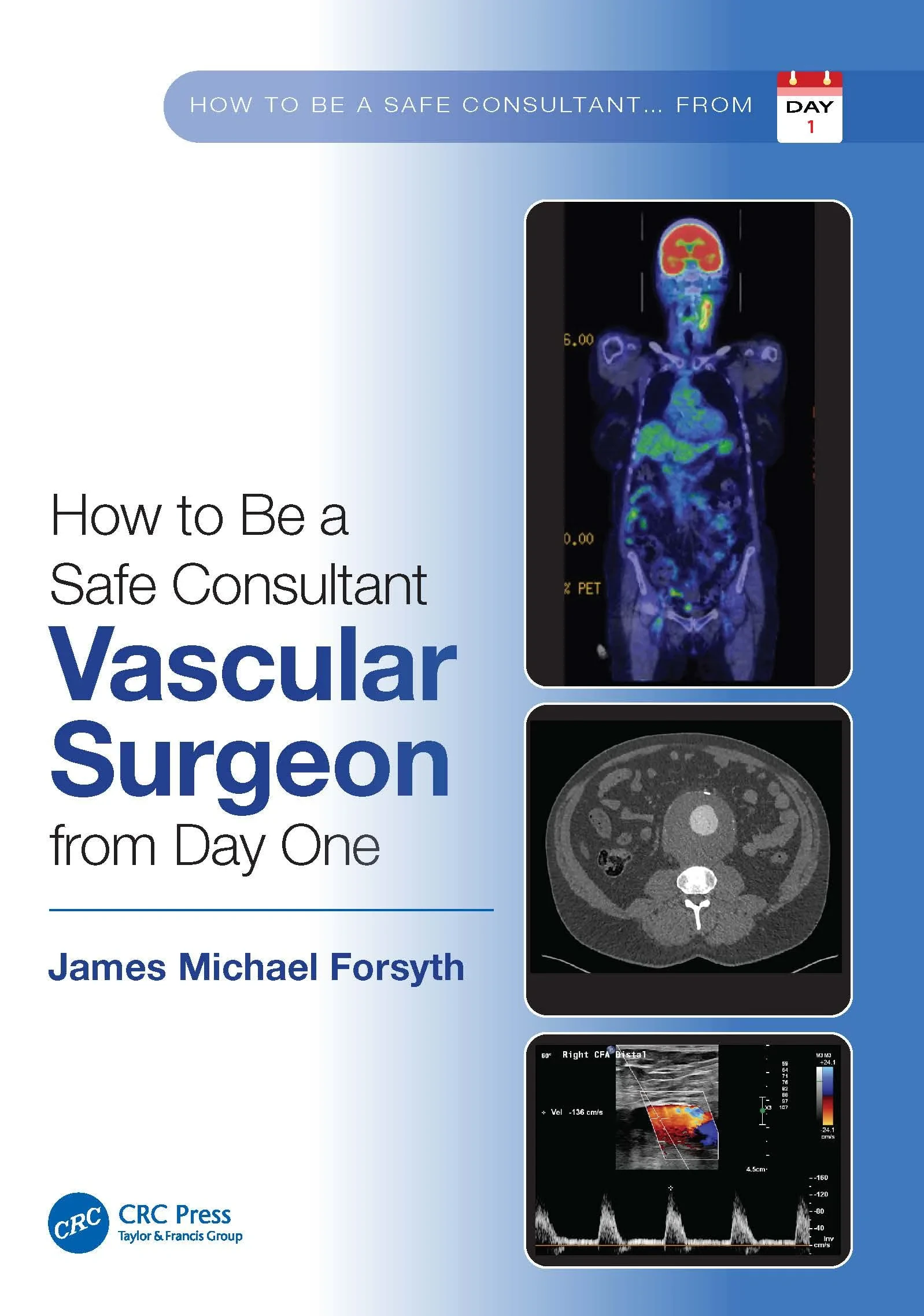 Coperta cărții "How to be a Safe Consultant Vascular Surgeon from Day One" de James Forsyth