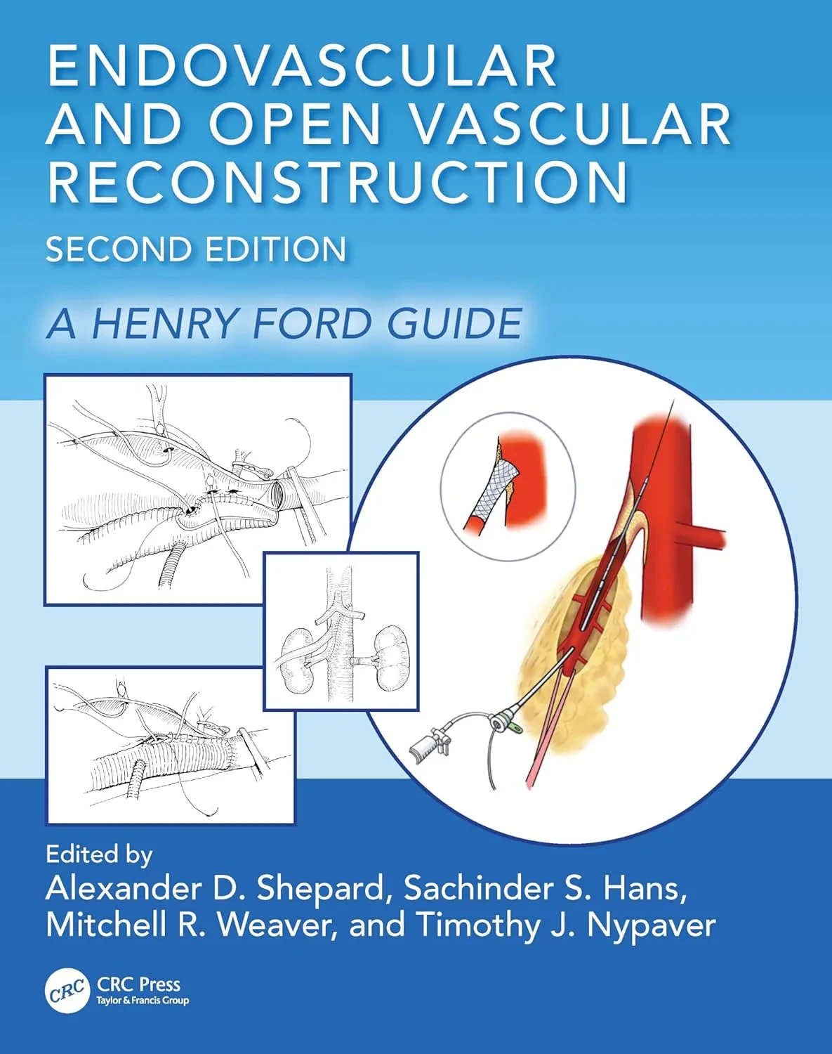 Coperta cărții "Endovascular and Open Vascular Reconstruction: A Henry Ford Surgical Guide 2nd Edition" de Sachinder Singh Hans, Alexander D Shepard, Mitchell R Weaver, Timothy J Nypaver