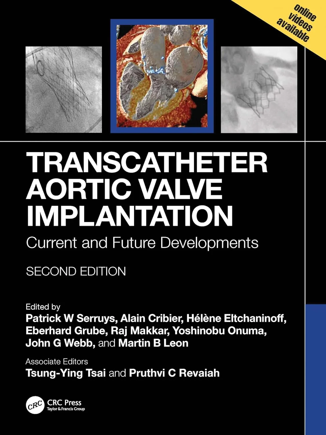 Coperta cărții "Transcatheter Aortic Valve Implantation: Current and Future Developments" de Yoshinobu Onuma, Patrick W. Serruys, Alain Cribier, Helene Eltchaninoff, Eberhard Grube, Raj Makkar, John G. Webb, Martin B. Leon