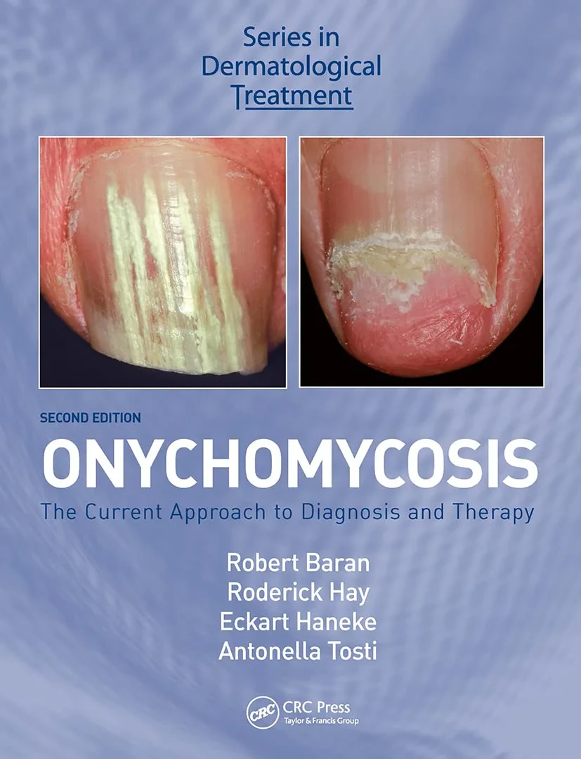 Coperta cărții "Onychomycosis: The Current Approach to Diagnosis and Therapy" de Robert Baran, Eckart Haneke, Antonella Tosti, Roderick Hay