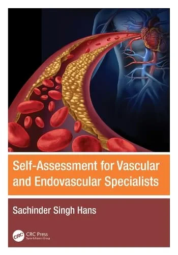 Coperta cărții "Self-Assessment for Vascular and Endovascular Specialists" de Sachinder Singh Hans
