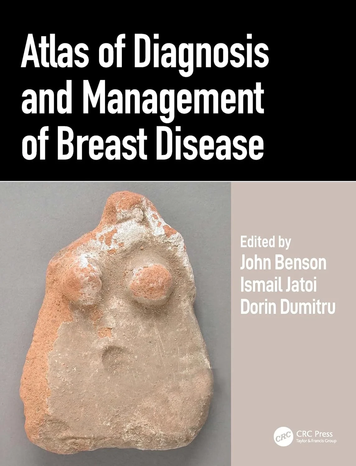 Coperta cărții "Atlas of Diagnosis and Management of Breast Disease" de John Benson, Ismail Jatoi, Dorin Dumitru