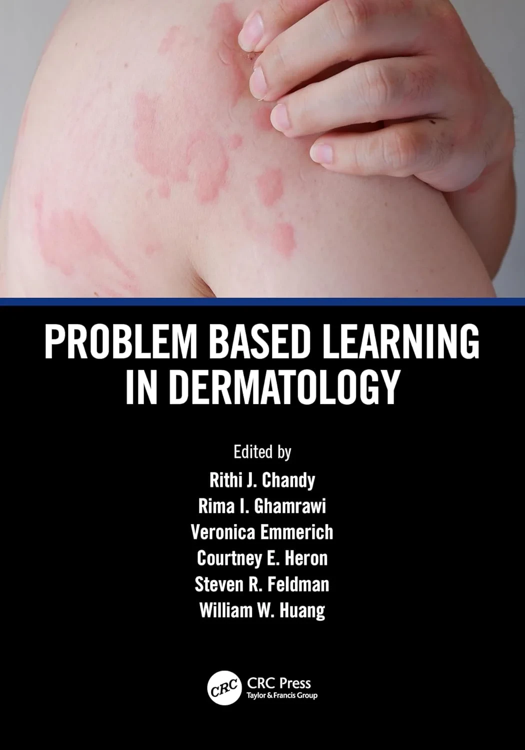 Coperta cărții "Problem Based Learning in Dermatology " de Rithi John Chandy, Rima I. Ghamrawi, Veronica Emmerich, Courtney E. Heron, Steven R. Feldman, William W. Huang