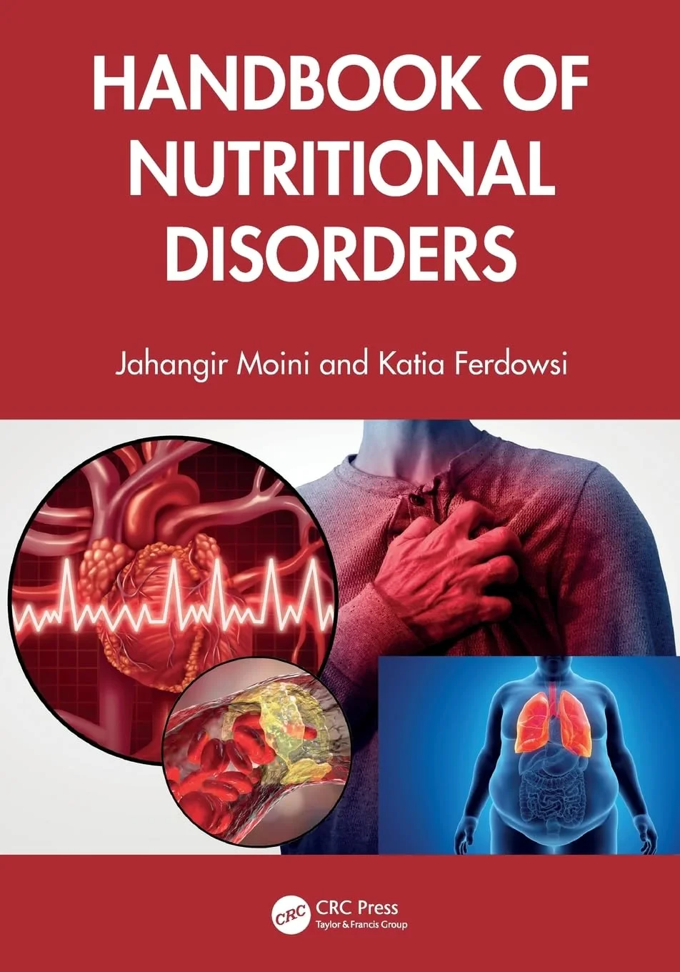 Coperta cărții "Handbook of Nutritional Disorders " de Jahangir Moini, Katia Ferdowsi