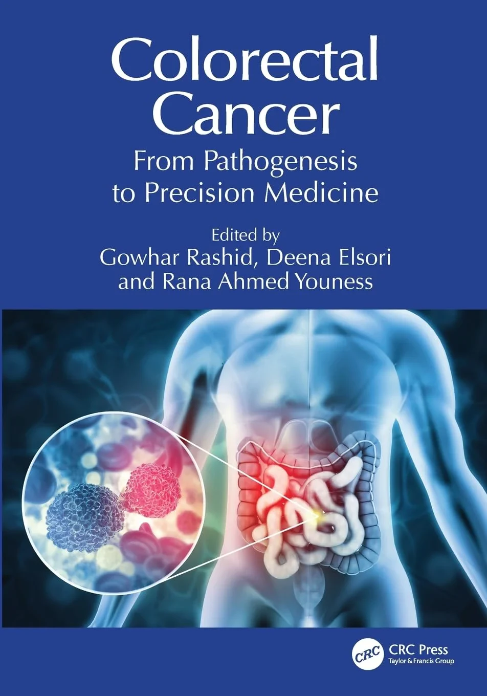 Coperta cărții "Colorectal Cancer: From Pathogenesis to Precision Medicine" de Deena Elsori, Gowhar Rashid, Rana Ahmed Youness
