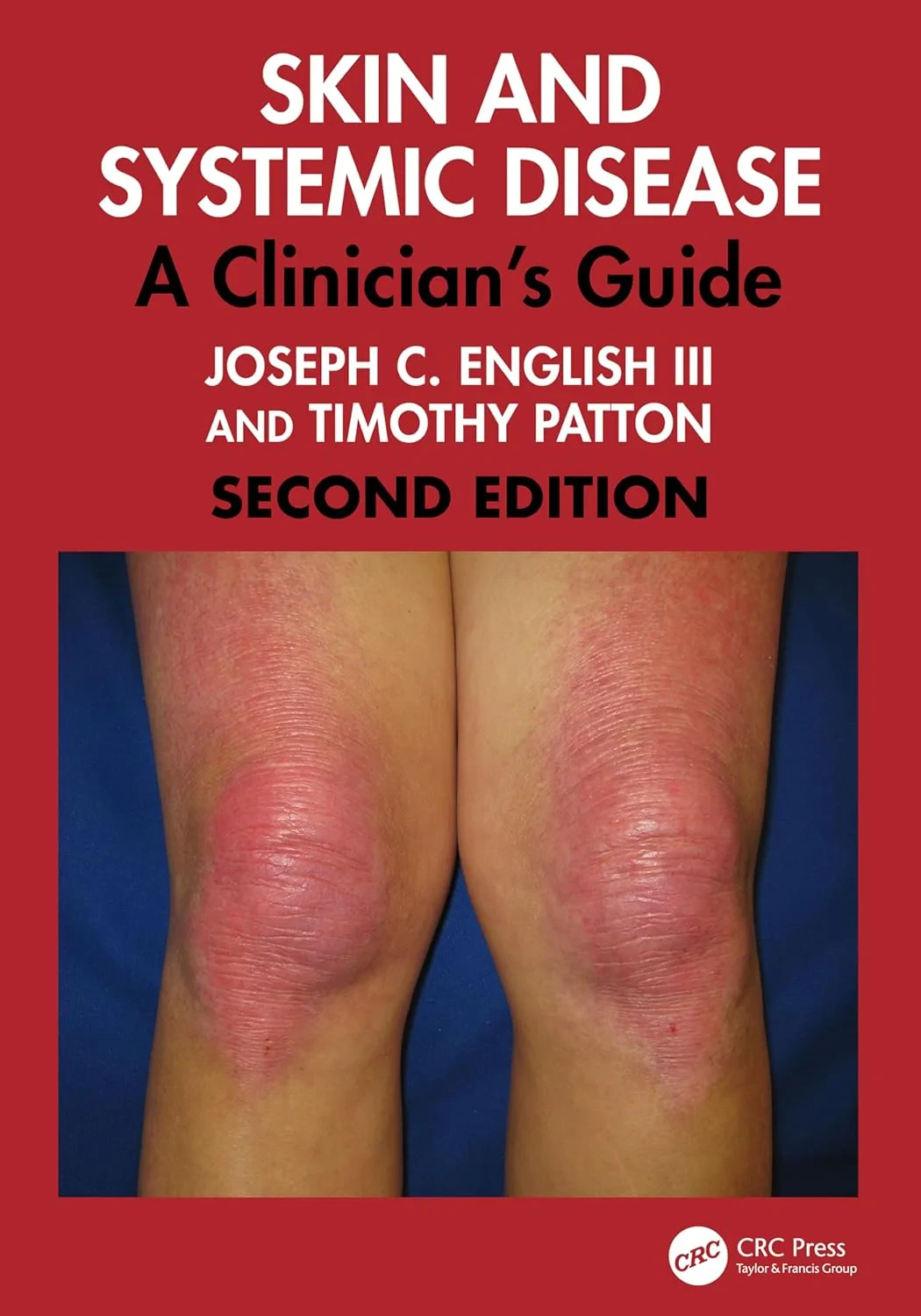 Coperta cărții "Skin and Systemic Disease. A Clinician's Guide" de Joseph C. English III, Timothy J. Patton
